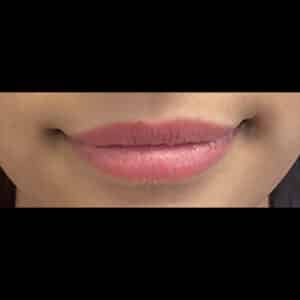 Before Image: Exion Lips – By Jes