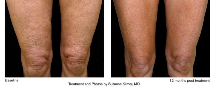 19e4ac_bcd01e440e55449999a38606c48c3ddemv2_d_3000_2400_s_4_2